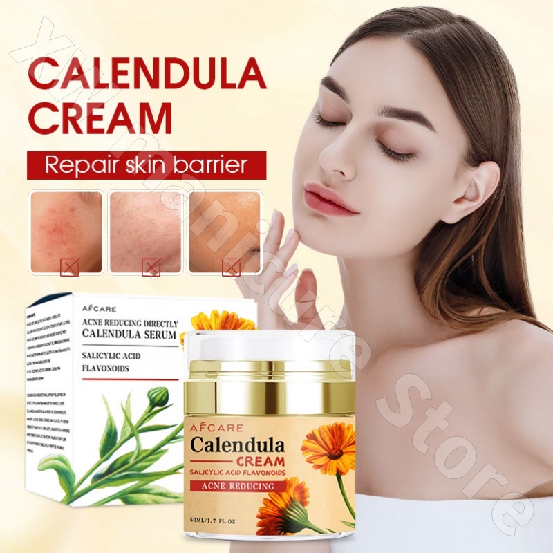 Skincare Luxury Whitening - Onarıcı Calendula Krem Nemlendirici ve Gençleştirici