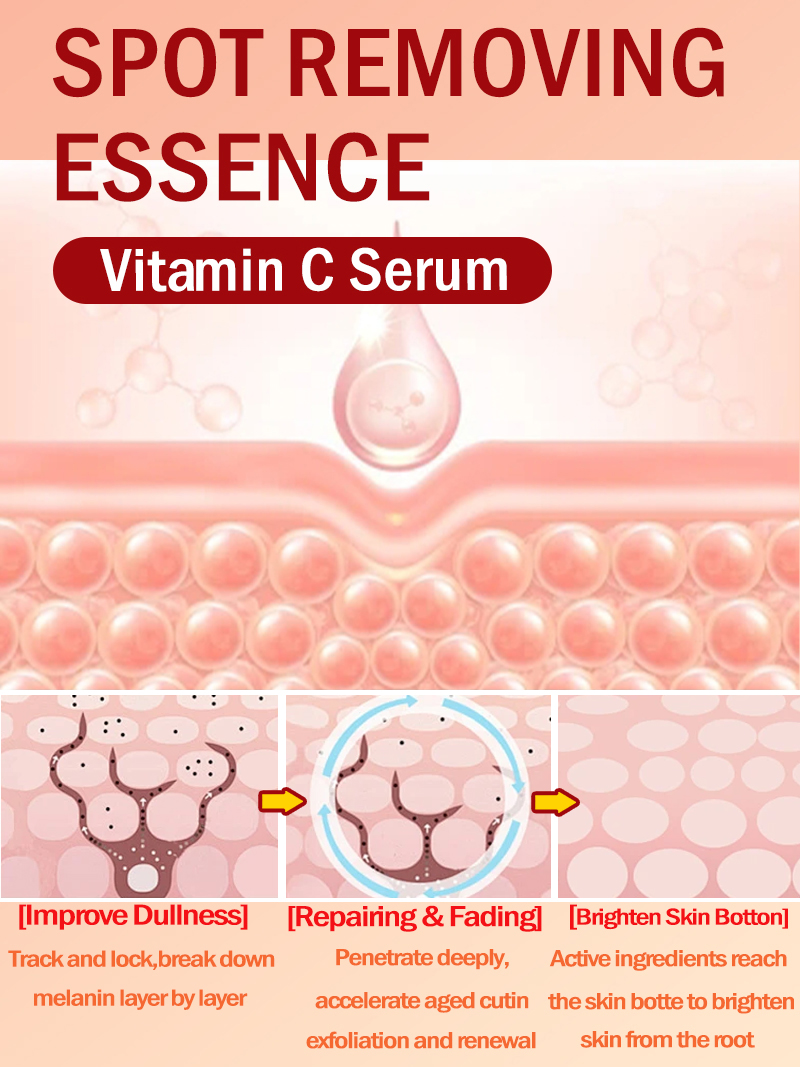 Çilleri, Melazmayı ve Yüzdeki  - Skincare Luxury Whitening incelemesi ve fiyatı
